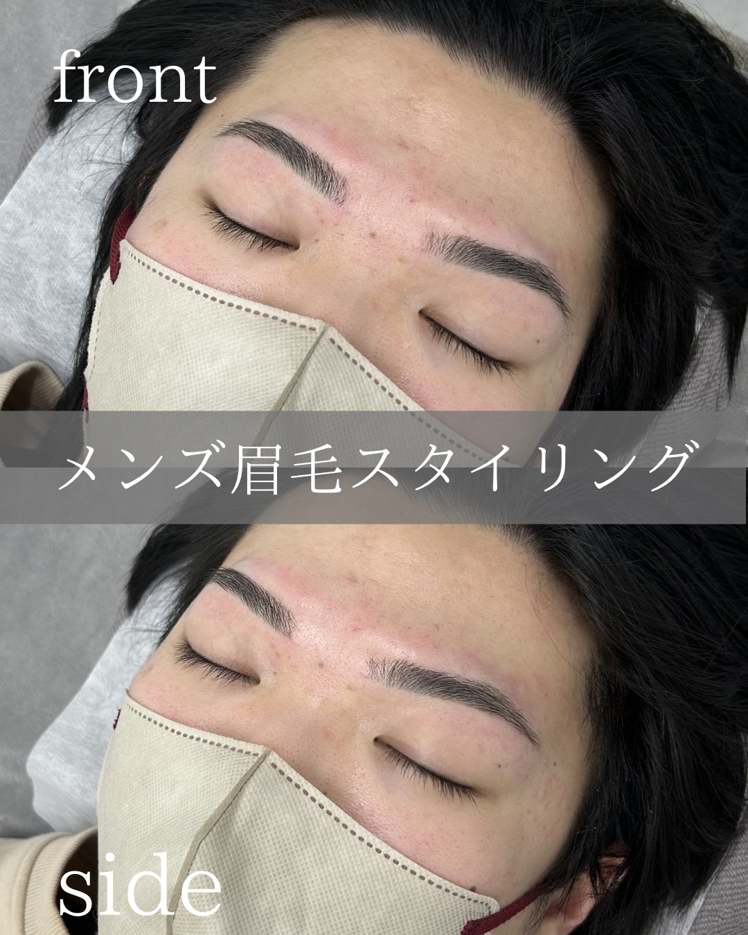 横浜 メンズ眉毛サロン ビフォーアフター 施術事例 20代男性