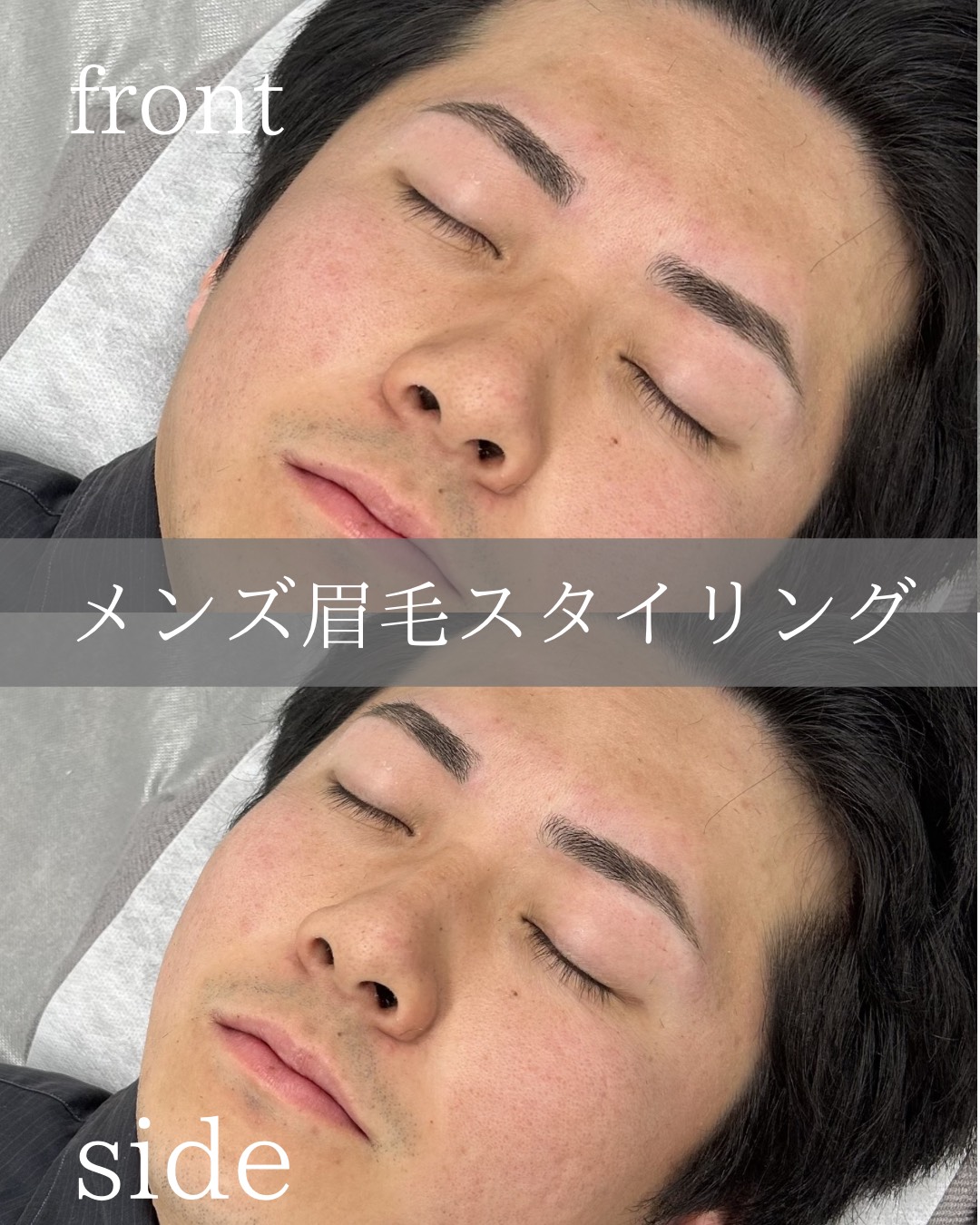 横浜 メンズ眉毛サロン ビフォーアフター 施術事例 30代男性
