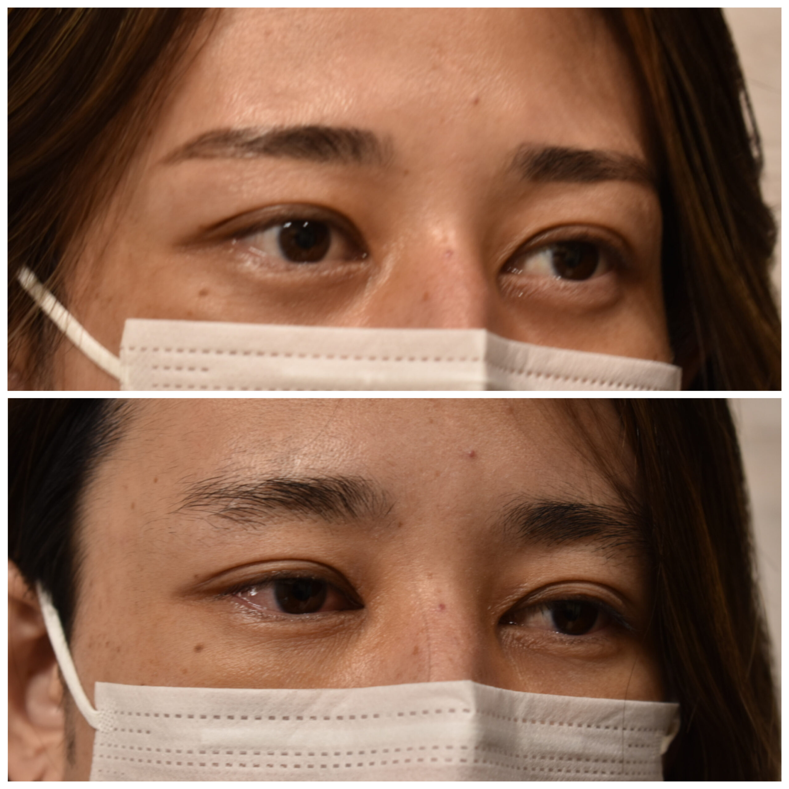 横浜 メンズ眉毛サロン 自己処理失敗 剃りすぎ 施術事例