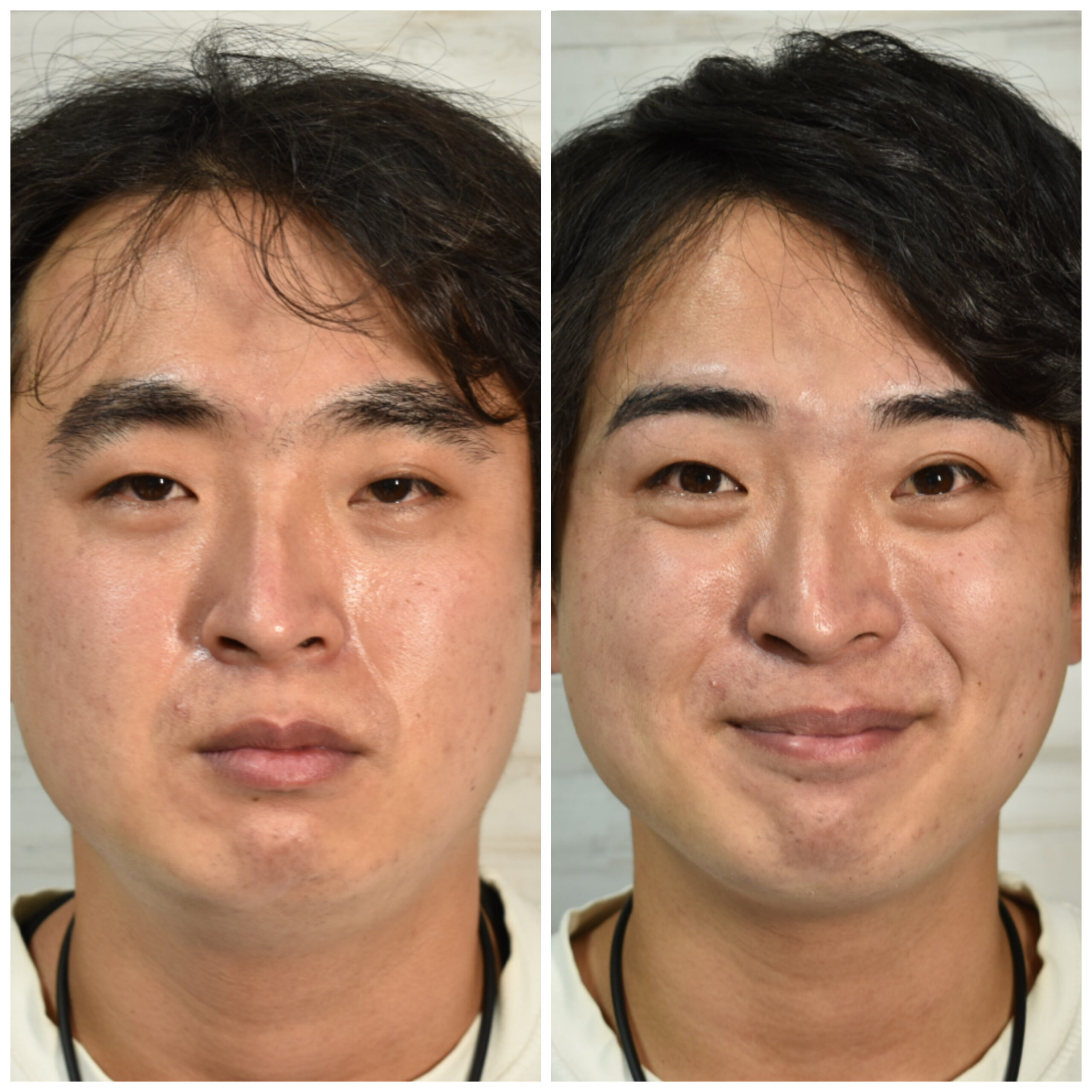 横浜 メンズ眉毛サロン ビフォーアフター ナチュラル 30代男性
